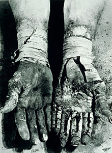 4S04791 Die befreiung der finger n°6